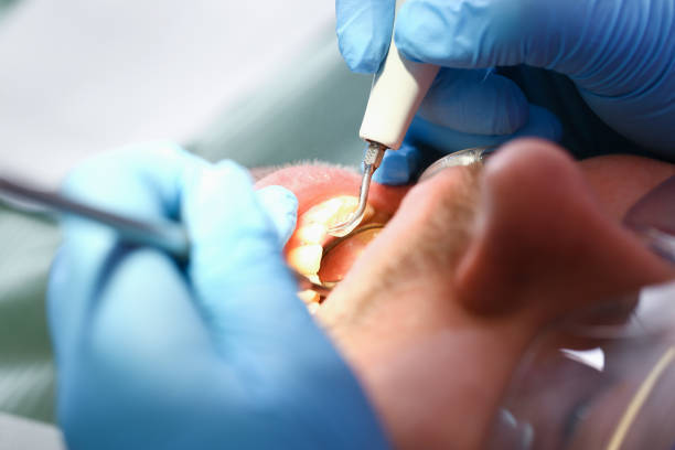 Best Weekend Emergency Dentist in Owensville, IN