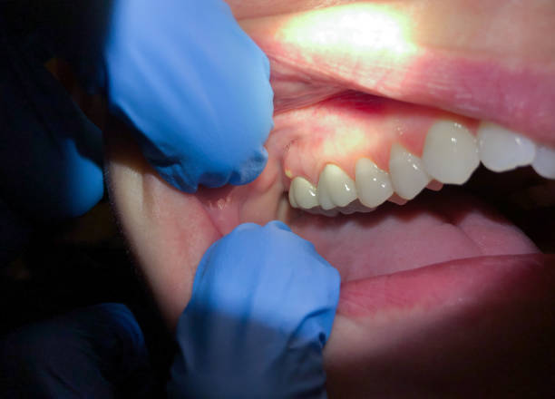 Best Emergency Dentist for Special Needs Patients in Owensville, IN