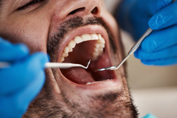 Best Urgent Dental Care for Toothache in Owensville, IN