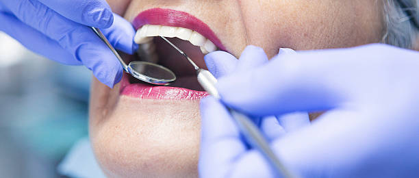 Best Emergency Root Canal Treatment in Owensville, IN